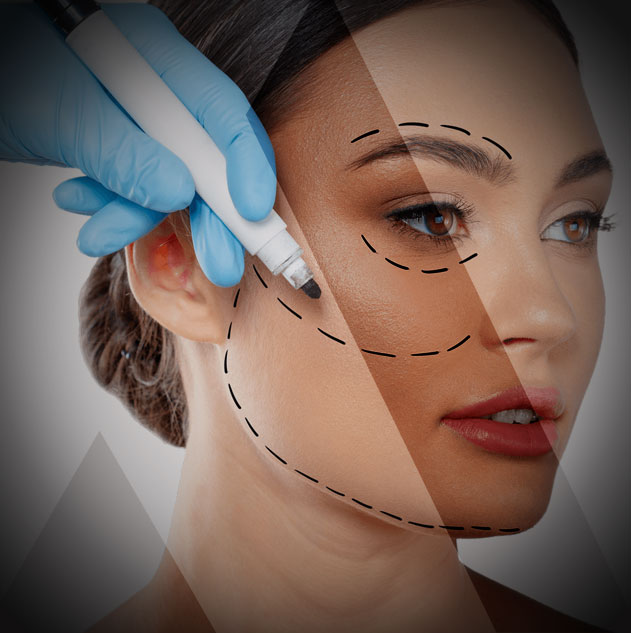 lifting cervico facial